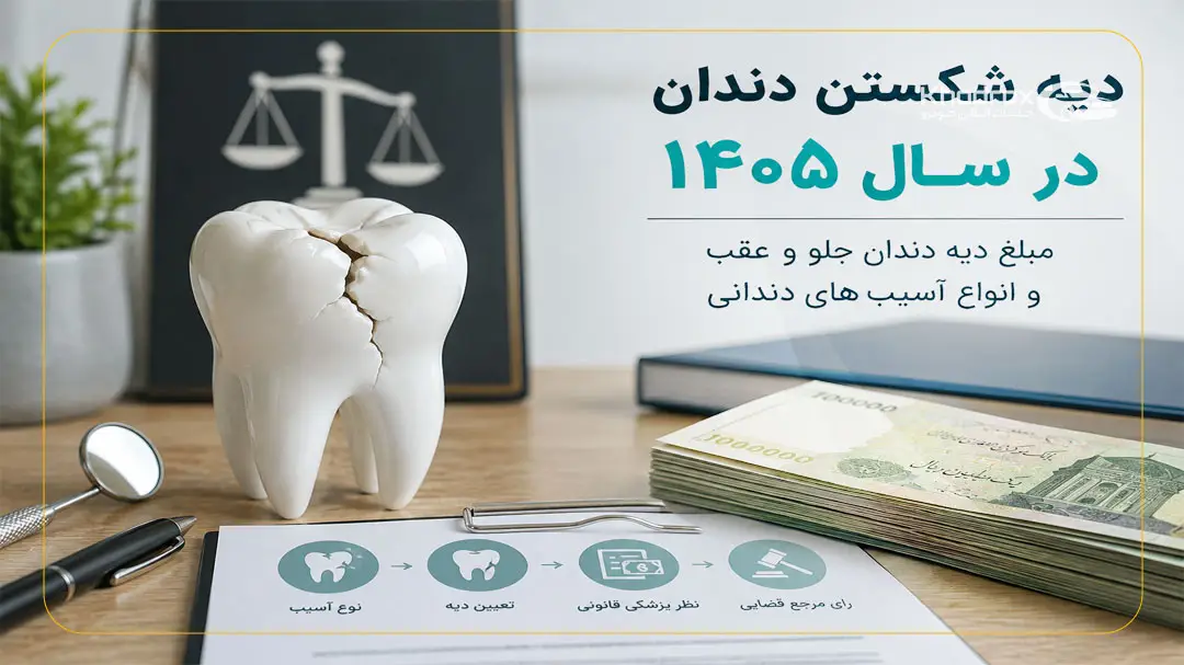 دیه دندان در قانون چگونه محاسبه می شود